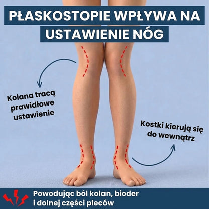 Noxea™ Wkładki Przywracające Naturalną Krzywiznę Stopy