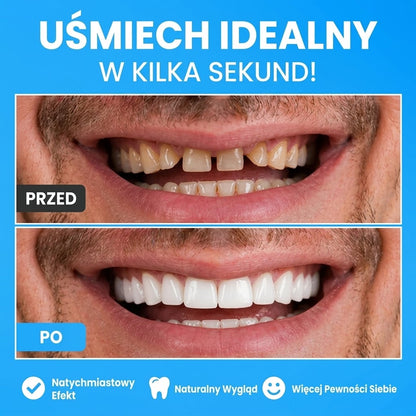 Noxea™ Nakładki Na Zęby